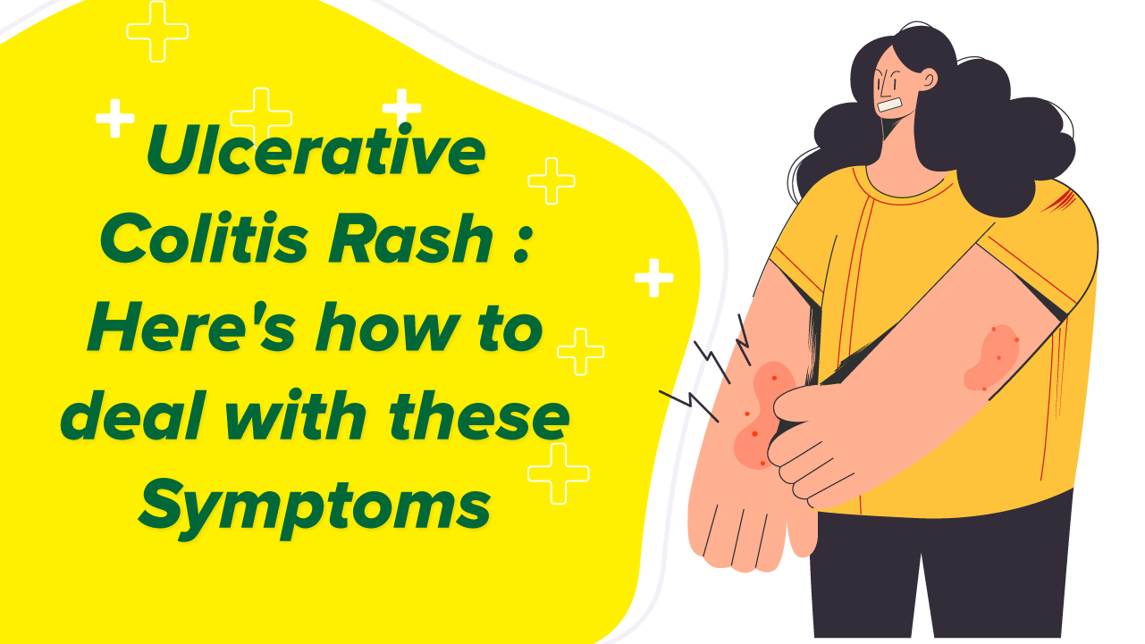 Ulcerative Colitis Rash: Here’s How to Deal with these Symptoms