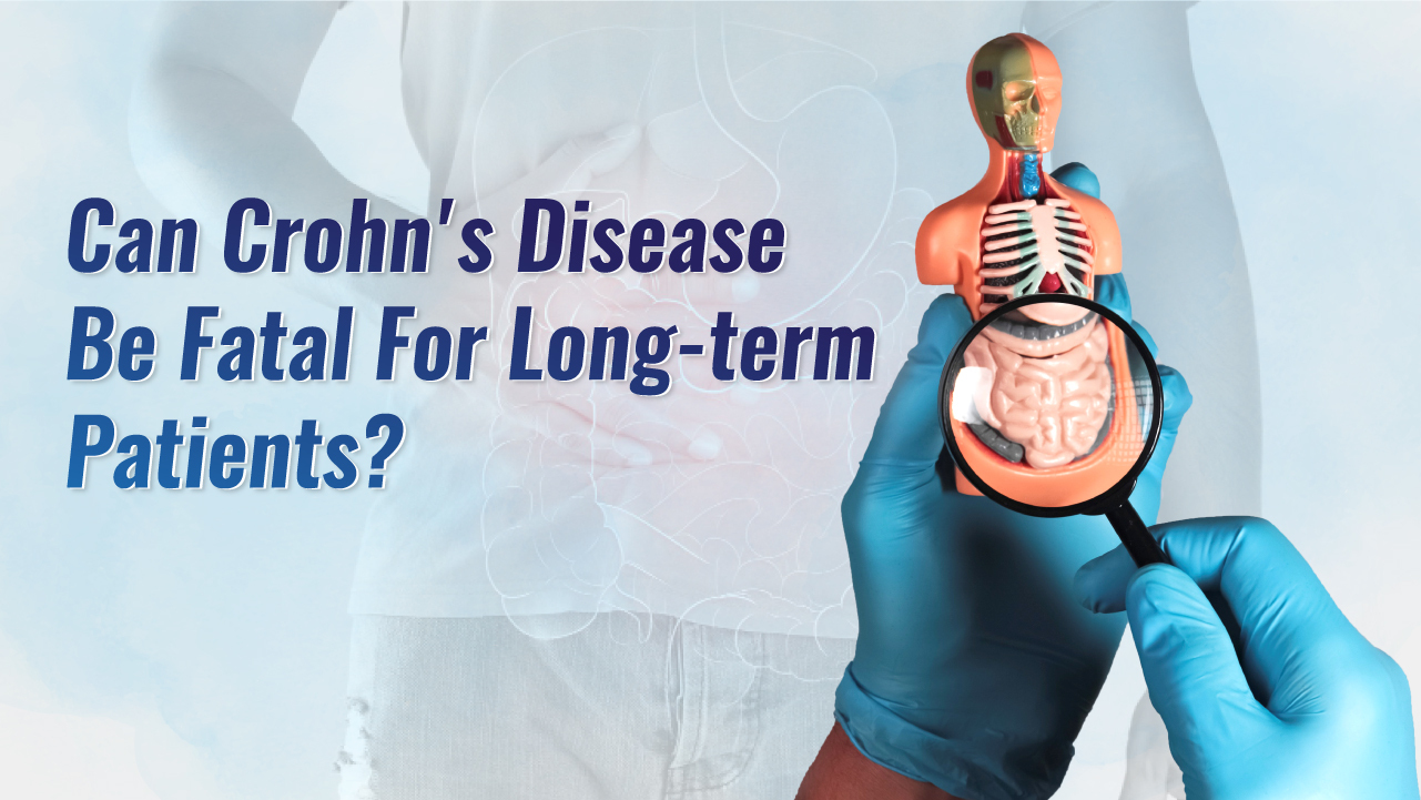 Can Crohn’s Disease be Fatal for Long-term Patients?