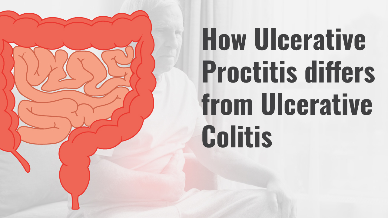 Ulcerative Proctitis vs. Ulcerative Colitis: What Are the Differences?