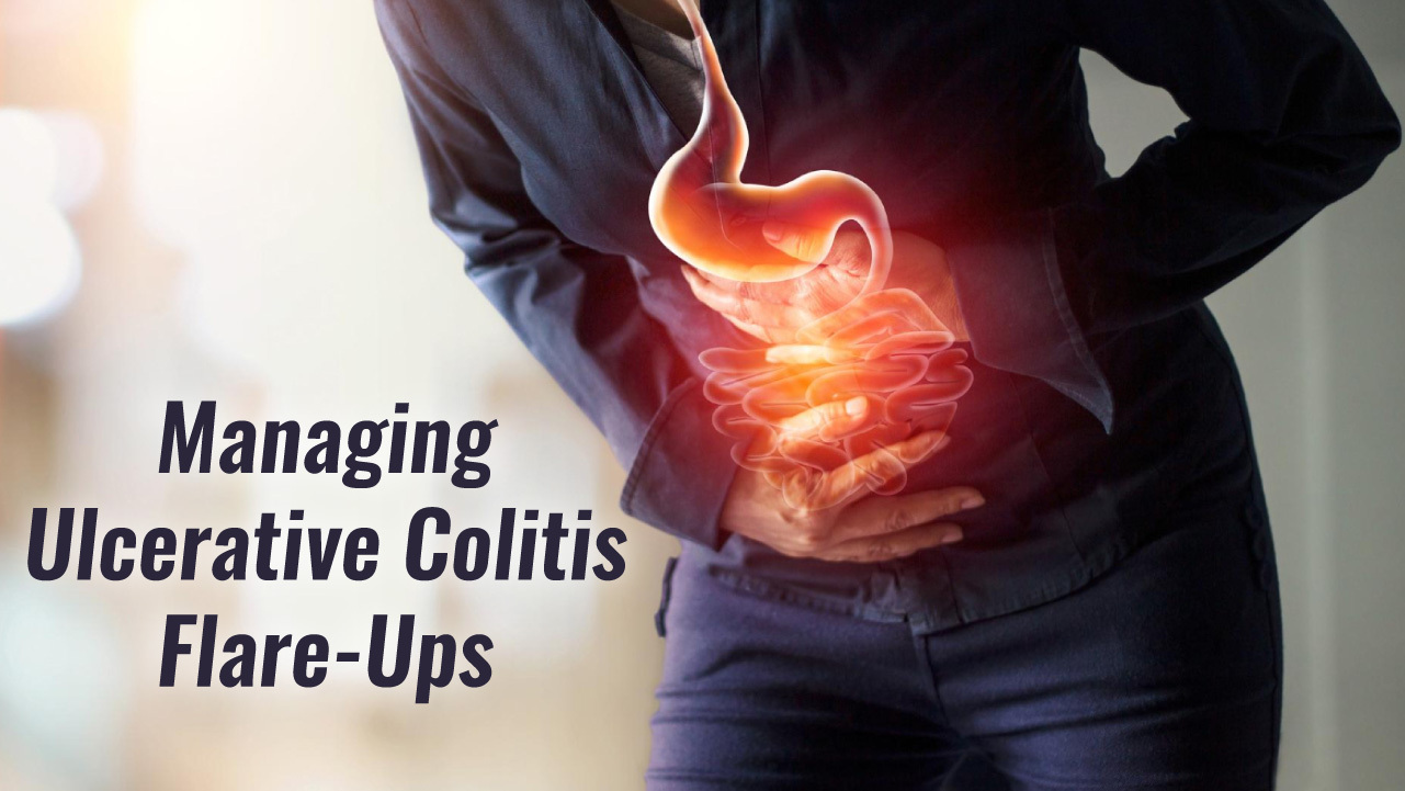 Tips on How to Manage an Ulcerative Colitis Flare-up?